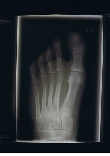xray